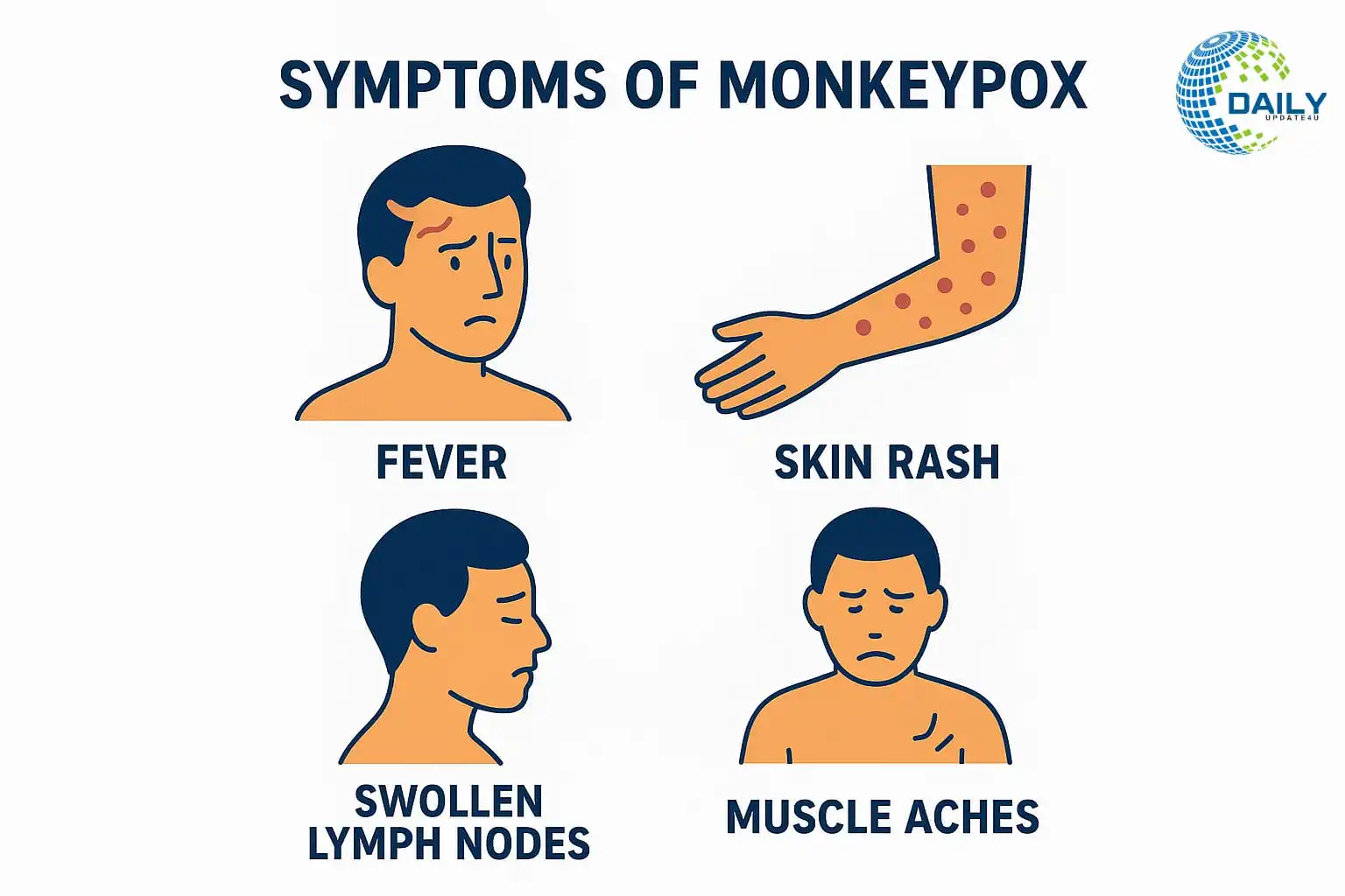 Rising Monkeypox Cases: Warning for the U.S. and Beyond